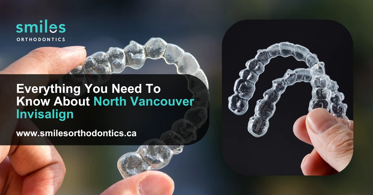Everything You Need To Know About North Vancouver Invisalign