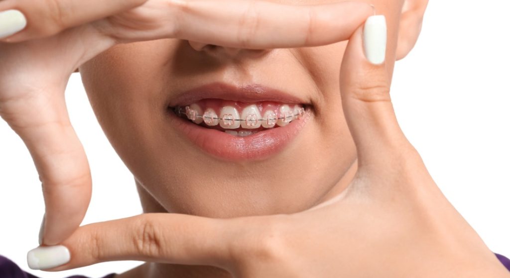 orthodontist vancouver bc