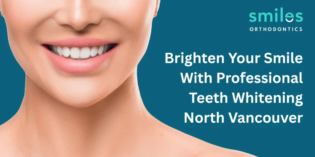 professional teeth whitening north vancouver