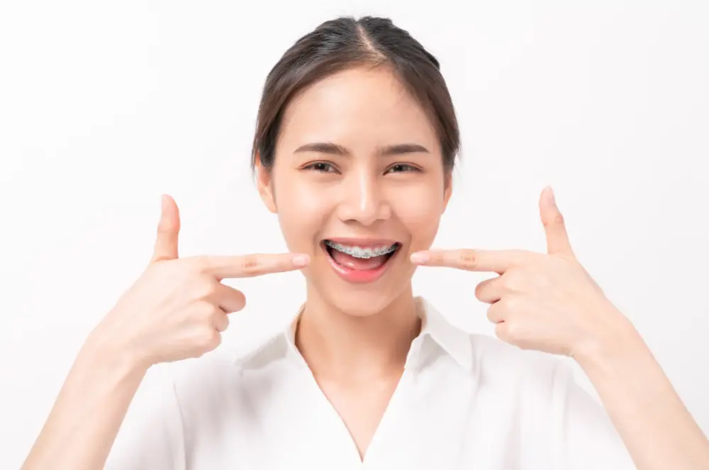 color braces for teeth (7)